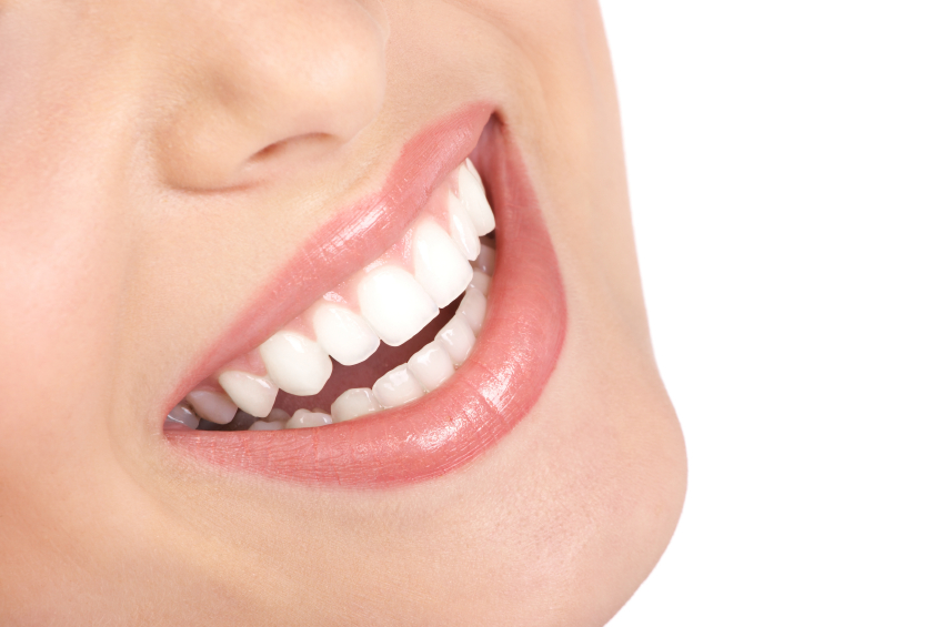 teeth whitening burbank